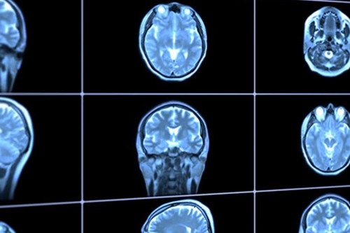 Graduate Program in Neuroscience
